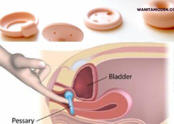 cara-mengatasi-kentut-faraj