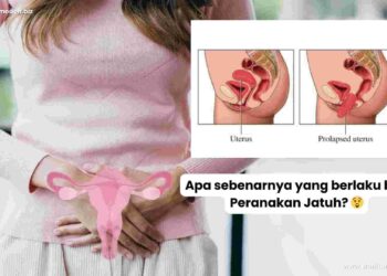 apa yang berlaku bila peranakan jatuh