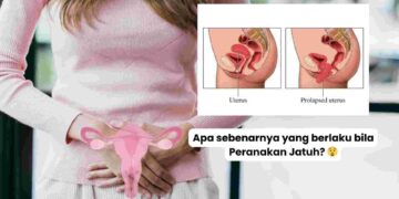 apa yang berlaku bila peranakan jatuh